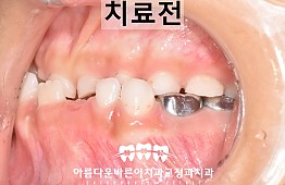 수술전