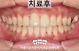 수술후