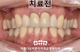 수술전