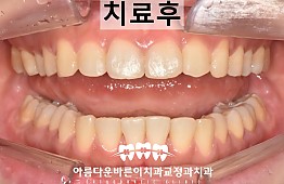 수술후