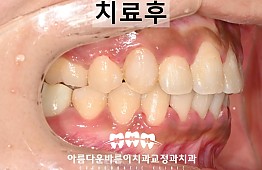 수술후
