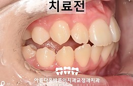 수술전