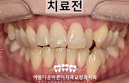 수술전