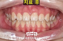 수술후