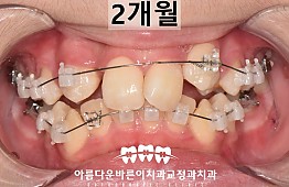 수술후