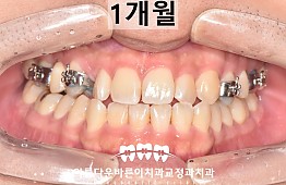 수술후