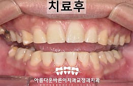 수술후