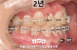 수술후