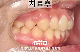 수술후