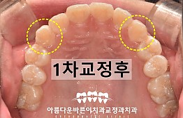 수술후