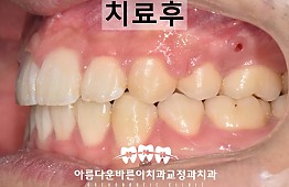 수술후