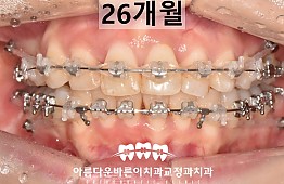 수술후