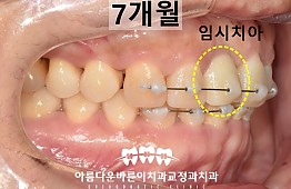 수술후