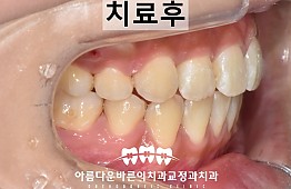 수술후