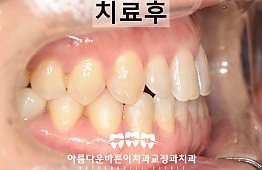 수술후