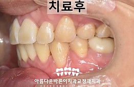 수술후