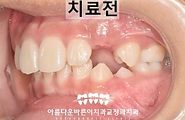 수술전