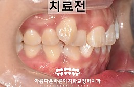 수술전