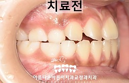 수술전