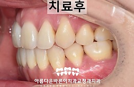 수술후