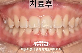 수술후