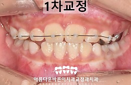 수술후