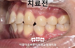 수술전