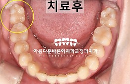 수술후