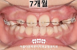 수술후