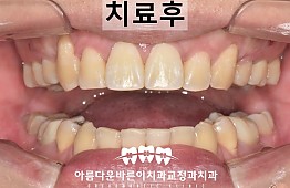 수술후