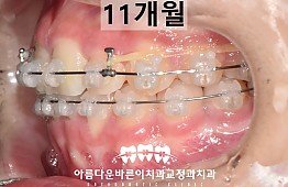 수술후