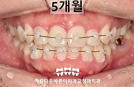 수술후