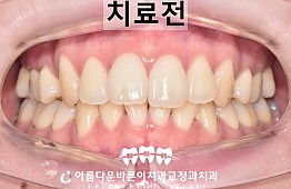 수술전