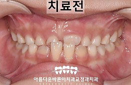 수술전