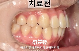 수술후