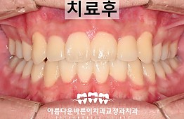수술후