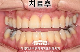 수술후