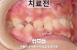 수술전