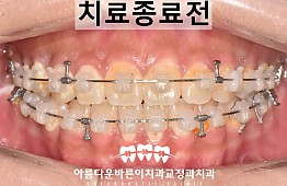 수술후