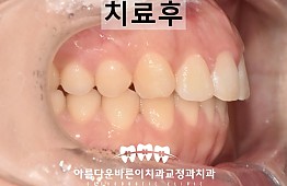 수술후