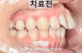 수술전