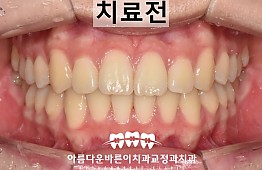 수술후