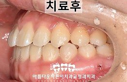 수술후