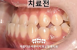 수술전