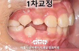 수술후