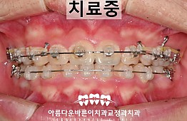 수술후