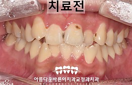 수술전