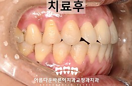 수술후