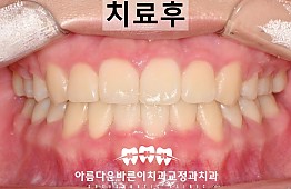 수술후