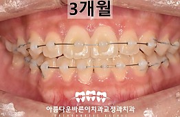 수술후